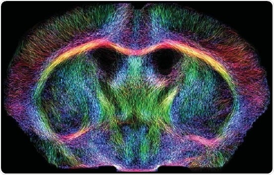 DTI fibers of the live mouse brain.