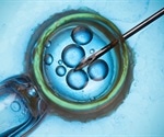 Multiple cycles with IVF lead to higher chances of pregnancy success