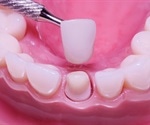Dental Crown / Tooth Cap