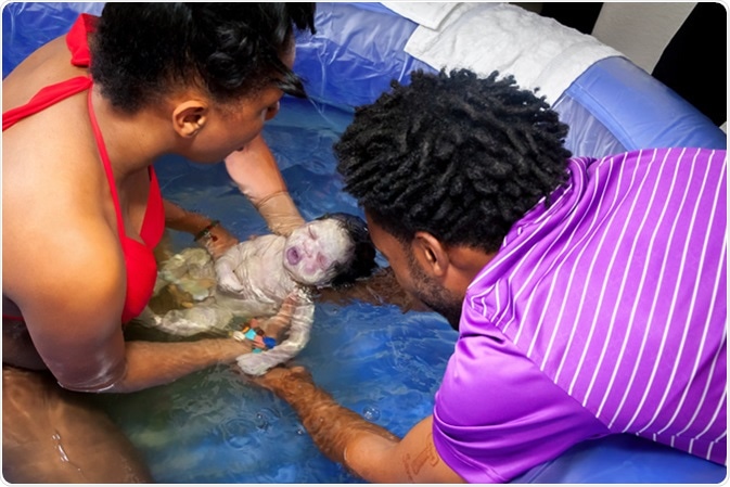 Couple delivers their newborn baby in a pool of water at home during a homebirth with help from their midwife. Image Credit: In The Light Photography / Shutterstock