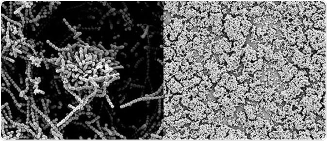 The close-up image on the left illustrates how Strep bacteria normally clump together to form a protective biofilm. The image of the right shows that the biofilm breaks down when a Strep culture is dosed with human milk sugars, exposing more of the bacteria to attack by antibacterial agents. (Steven Townsend / Vanderbilt)
