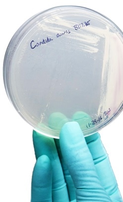 A strain of Candida auris cultured in a petri dish at CDC. image Credit: CDC