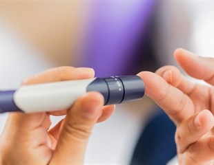 Research proposes non-invasive method to monitor diabetes