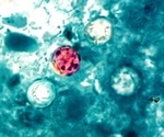 Increase in reported cases of Cyclospora infections compared to last year, CDC reports