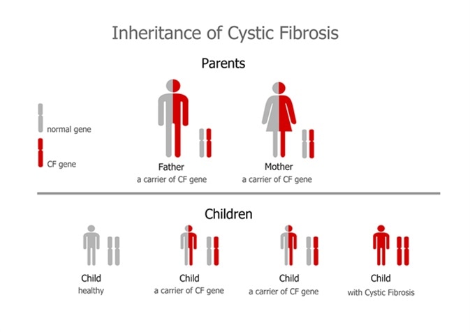 Cystic Fibrosis (mucoviscidosis) inheritance. Image Credit: Zuzanae / Shutterstock