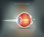 Diagnosing and Treating Hyperopia