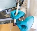 New device detects cancerous tissue during surgery within seconds