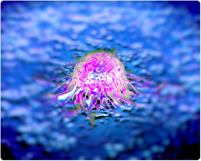 Prostate cancer cells. Image Credit: royaltystockphoto.com / Shutterstock
