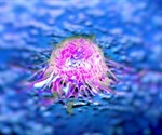 Prostate cancer screening reduces cancer deaths finds new analysis