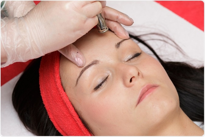Diamond microdermabrasion peeling on the forehead. Image Credit: Serko1982 / Shutterstock