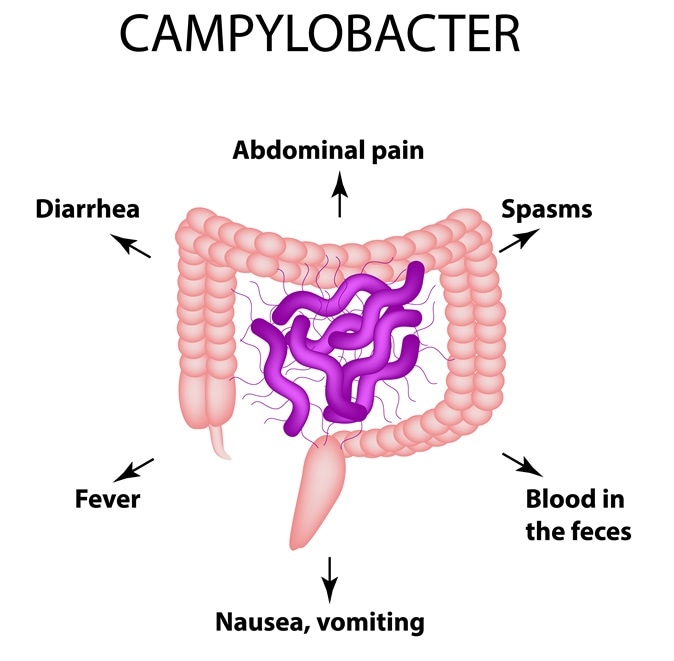 Campylobacter. Pathogenic flora. The bacterium causes intestinal diseases. Symptoms of infection. Image Credit: Timonina / Shutterstock