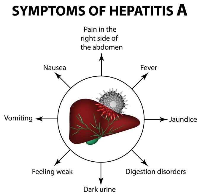 Symptoms of hepatitis A. Image Credit: Timonina / Shutterstock