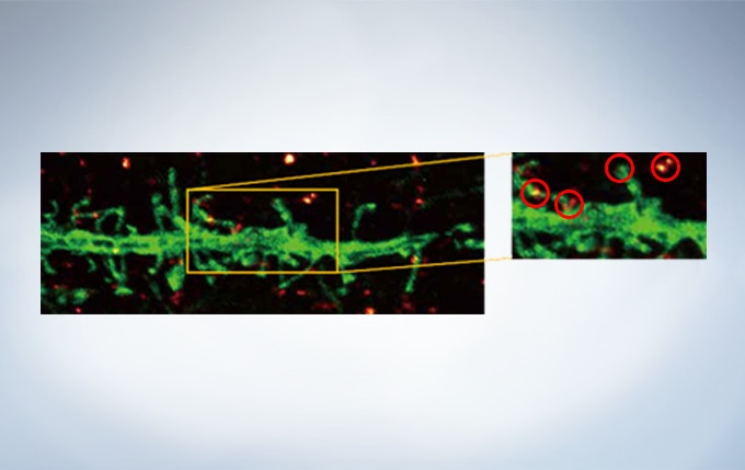 Olympus Super Resolution Plus cellSens Advanced Deconvolution. Note clear separation of punctate stains with OSR.