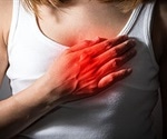 Women more likely than men to die from a heart attack due to treatment disparity