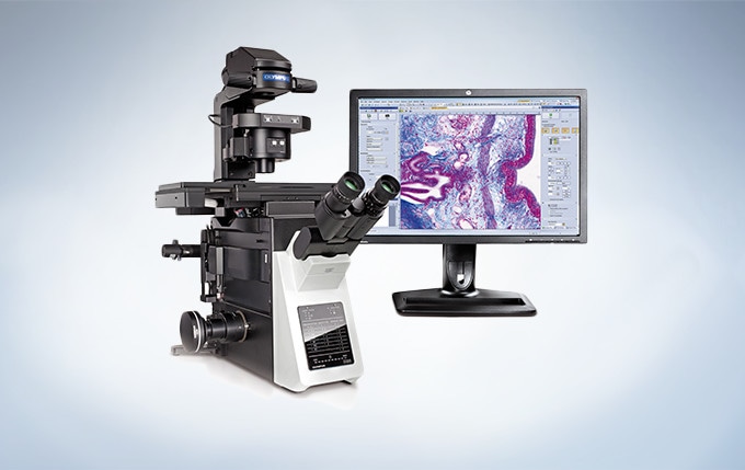UC90 with Microscope and Monitor