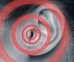 Scientists develop promising new approach to tinnitus treatment
