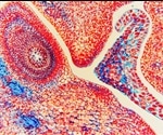 Label Free Tissue Imaging Using a Raman Microscope