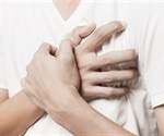 Stressors Associated with Takotsubo Cardiomyopathy
