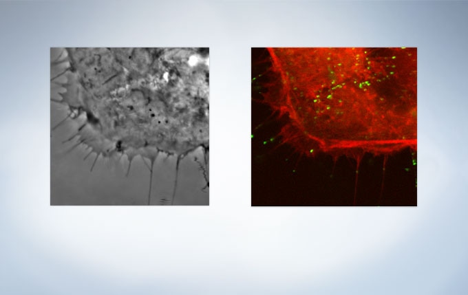 HeLa cell expressing mCherry-actin (Image data courtesy of: Tomonobu Watanabe, Ph.D. Laboratory for Comprehensive Bioimaging, RIKEN Quantitative Biology Center)