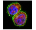 Scientists discover mechanism that amplifies autoimmune reaction in early stage islet autoimmunity
