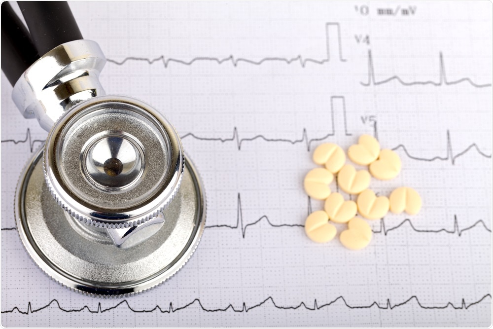 ECG of irregular heartbeat - patient who needs anticoagulants - By Ocskay Mark