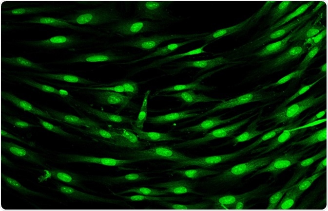 Fluorescent cells - Vshivkova
