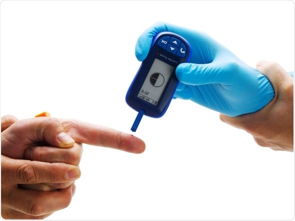EKF’s new Lactate Scout 4 hand-held analyzer for rapid field-based lactate measurement.