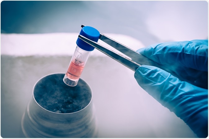 A Liquid Nitrogen bank containing suspension of stem cells. Cell culture for the biomedical diagnostic. Image Credit: Elena Pavlovich / Shutterstock