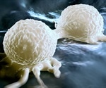 Breast cancer survival could be extended with two new drug combinations