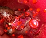 Circulating Tumor Cells and Cancer