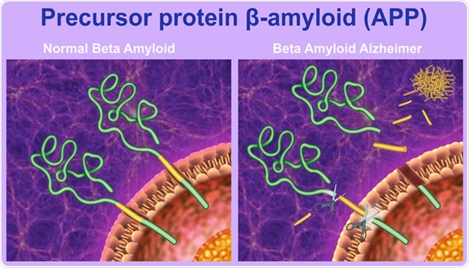 The proteolytic processing of the precursor protein beta-amyloid. Image Credit: Ilusmedical / Shutterstock