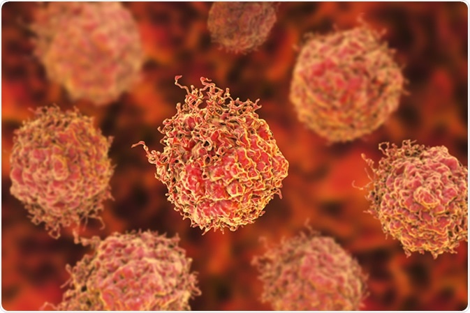 Prostate cancer cells, 3D illustration. Image Credit: Kateryna Kon / Shutterstock