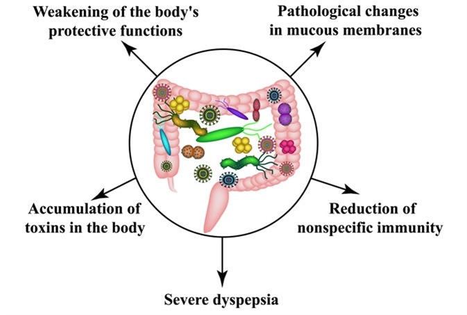 Consequences of intestinal dysbiosis. Dysbacteriosis of the colon. Image Credit: Timonina / Shutterstock