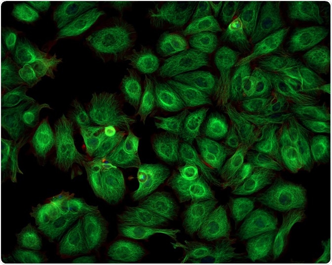 Cancer cells illuminated by fluorescence microscopy - By Caleb Foster