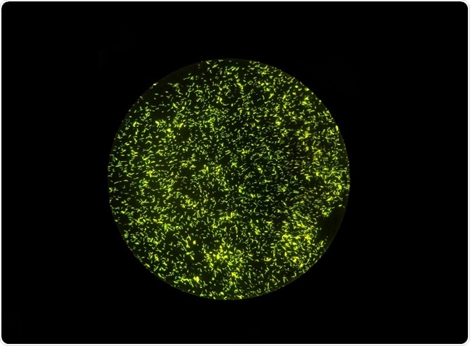 Fluorescent bacterial cells - By Jeerasak Meeraka