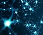Artificial intelligence technology improves prediction of Alzheimer’s disease