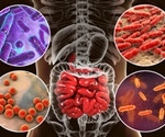 Parkinson's Disease and the Gut Microbiome