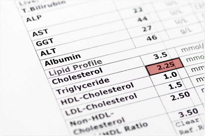 Blood chemistry report showing normal liver function tests, and a lipid profile with high triglyceride levels. Image Credit: Stephen Barnes / Shutterstock