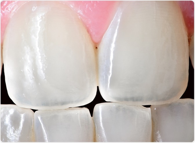 Extreme close up of the front incisor teeth of an adult human female. Image Credit: Muskoka Stock Photos / Shutterstock