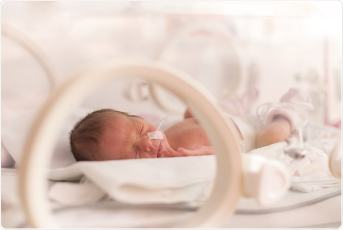 Premature newborn baby girl in the hospital incubator after c-section at 33 weeks. Image Credit: OndroM / Shutterstock