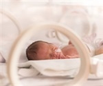 Premature births on the rise in the US says March of Dimes report