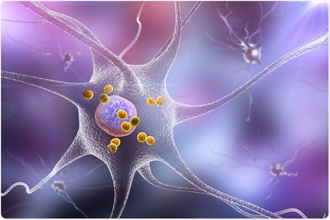 3D illustration showing neurons containing Lewy bodies small red spheres which are deposits of proteins accumulated in brain cells that cause their progressive degeneration. Image Credit: Kateryna Kon / Shutterstock