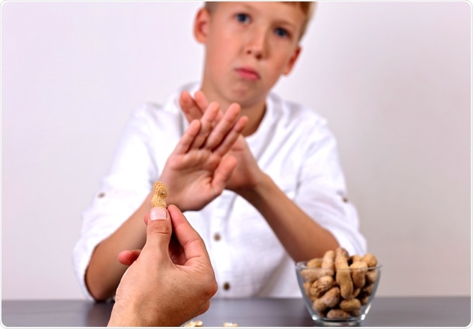 Peanut allergy. Image Credit: Albina Glisic / Shutterstock
