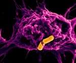 Microbiological analysis of bacteria that cause food poisoning could save lives