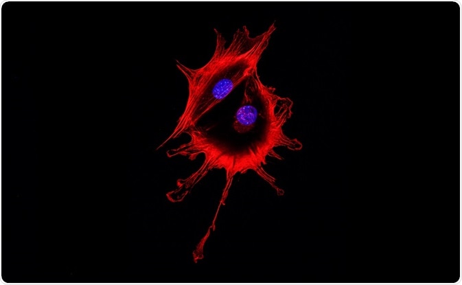 Cell visualized using fluorescence microscopy - two cells stuck together have to be removed using gating. By DrimaFilm