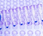 Real-time Quantitative PCR (RT-qPCR) in Research