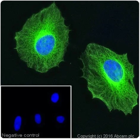 Immunocytochemistry of formaldehyde-fixed HeLa cells stained with anti-beta tubulin antibody (ab6046). The secondary antibody (green) was ab150081 Alexa Fluor® 488 goat anti-rabbit IgG. Nuclear DNA was labeled with DAPI (shown in blue). The negative control is a secondary only assay. Click here to view the full datasheet for ab6046. 10 µl trial size available.