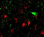 Researchers uncover genes that lead to excessive tau in dementia
