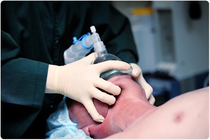Breath anesthetic gas through the face mask during induction in anesthesia. Image Credit: Sfam_photo / Shutterstock