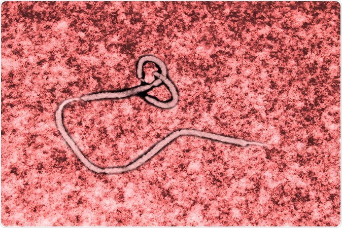 Ebola virus seen under a microscope. Image Credit: Studio_3321 / Shutterstock